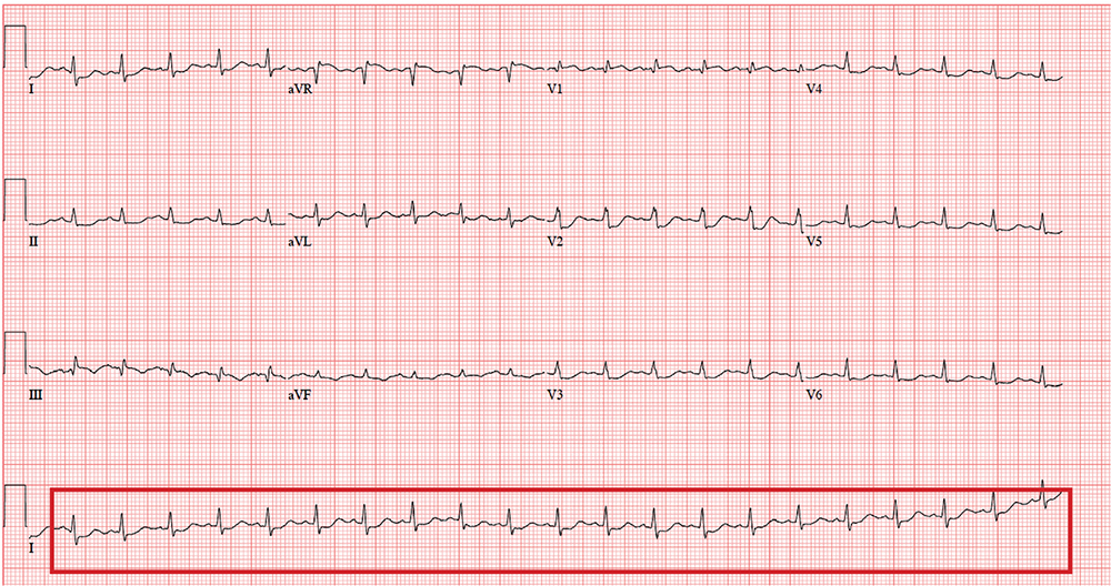 ecg-best-diagnostic-centre-pathology-lab